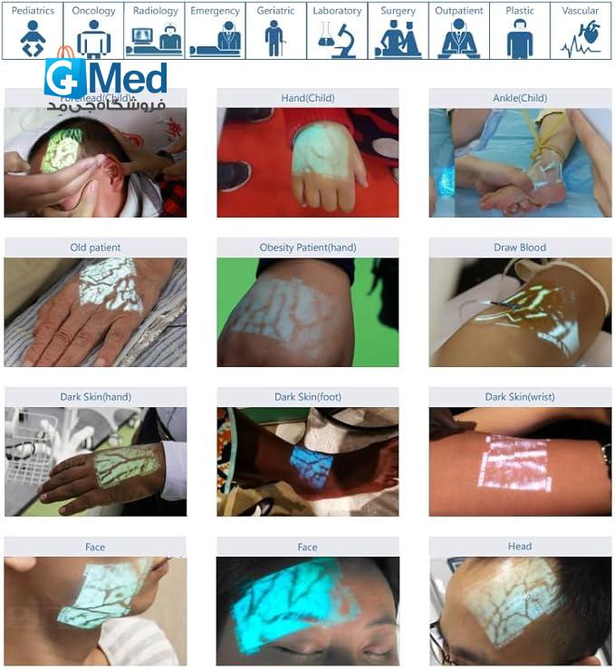 رگیاب ( رگ یاب ) ویدئوپروژکتوری ( لیزری ) برند VeinSihght مدل VS400
