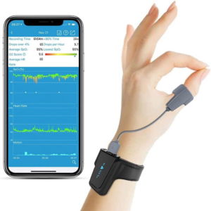 پالس اکسیمتر ( هولتر اکسیژن خون ) Viatom مدل Checkme O2