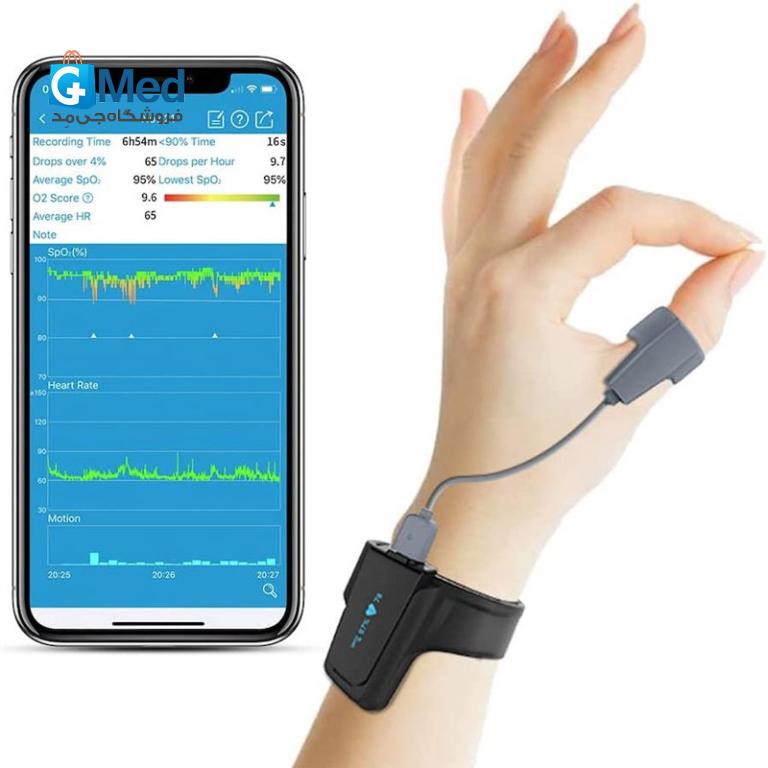 پالس اکسیمتر ( هولتر اکسیژن خون ) Viatom مدل Checkme O2