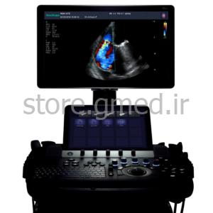 سونوگرافی کالر داپلر SonoScape مدل S50
